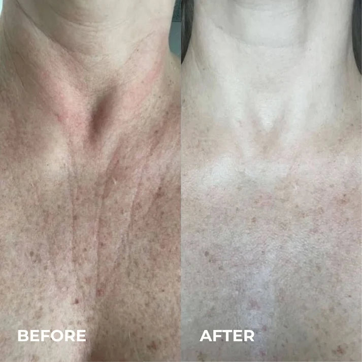 Harlin™ Line Smoother