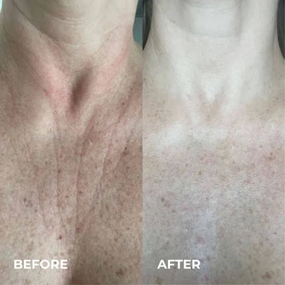 Harlin™ Line Smoother