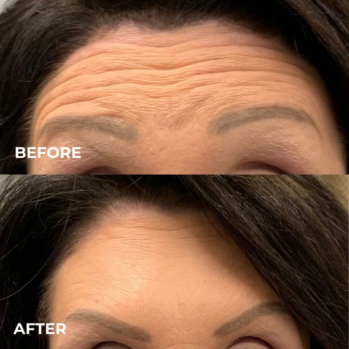 Harlin™ Line Smoother