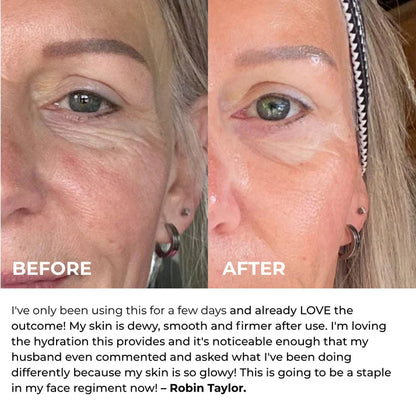 Harlin™ Line Smoother