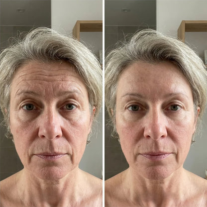 Harlin™ Line Smoother Perfect Skin in 3 Minutes